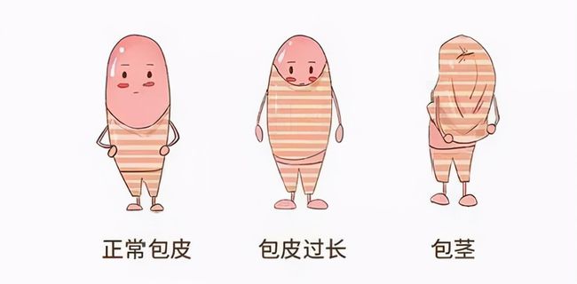 儿童包皮一定要切吗,齐齐哈尔附大男科ky（中国）官方网站-ky登录入口
